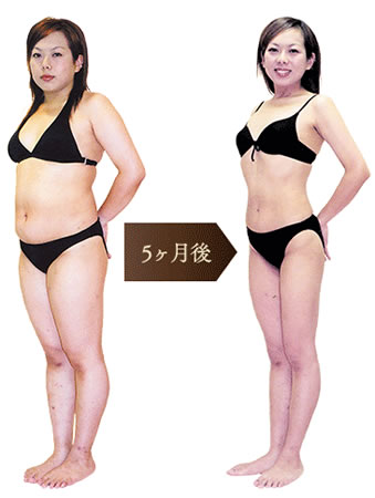 写真:5ヶ月後